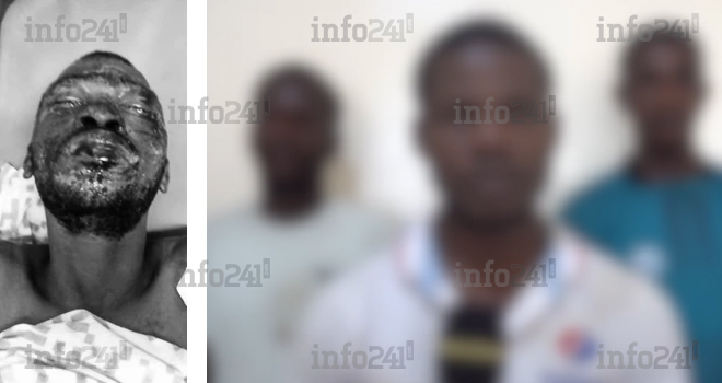 Port-Gentil&nbsp;: 3 suspects écroués après avoir brulé leur victime lors d’une cérémonie traditionnelle