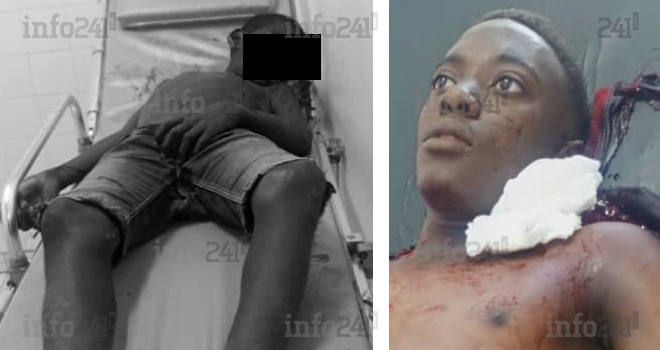 Excédé par ses blagues, un gabonais de 18 ans abat son neveu au calibre 12 avant de tenter de se suicider