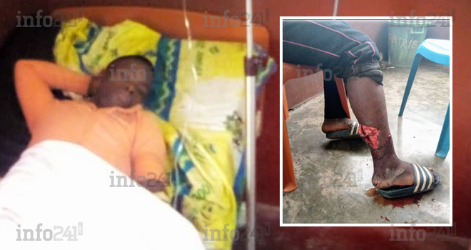 Deux jeunes chasseurs gabonais attaqués par un gorille au cours d’une partie de chasse