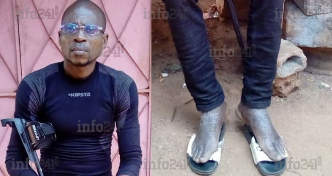 Lebamba&nbsp;: Déjà cocufié, un gabonais se voit paralyser des deux jambes par son rival nganga